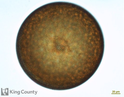 Photo of Coscinodiscus centralis